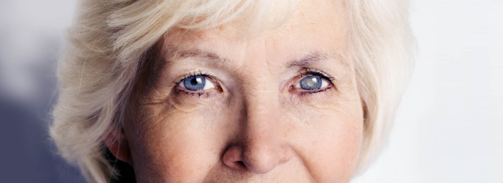 Cataract Surgery in Bellefontaine